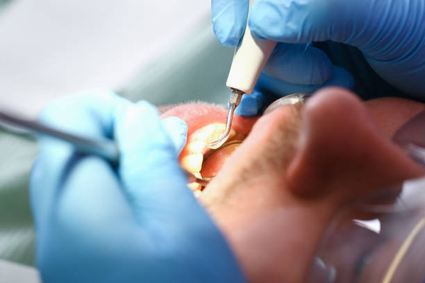 Best Broken or Cracked Tooth Emergency Dentist in Rollingwood, CA