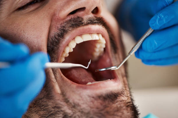 Best Emergency Dental Care for Abscessed Tooth in Rollingwood, CA